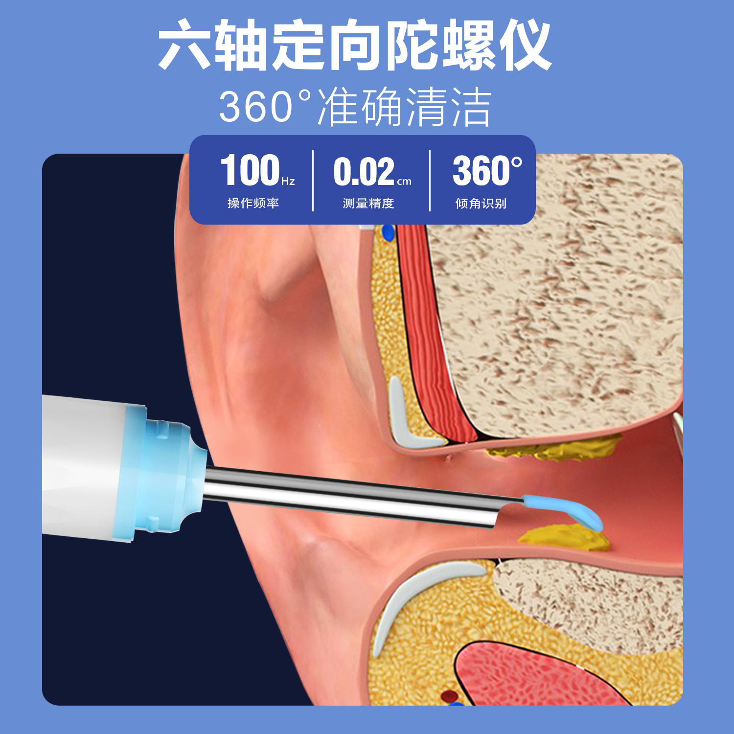 YY10 智能可視采耳器